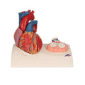 Magnetic Heart Model F185